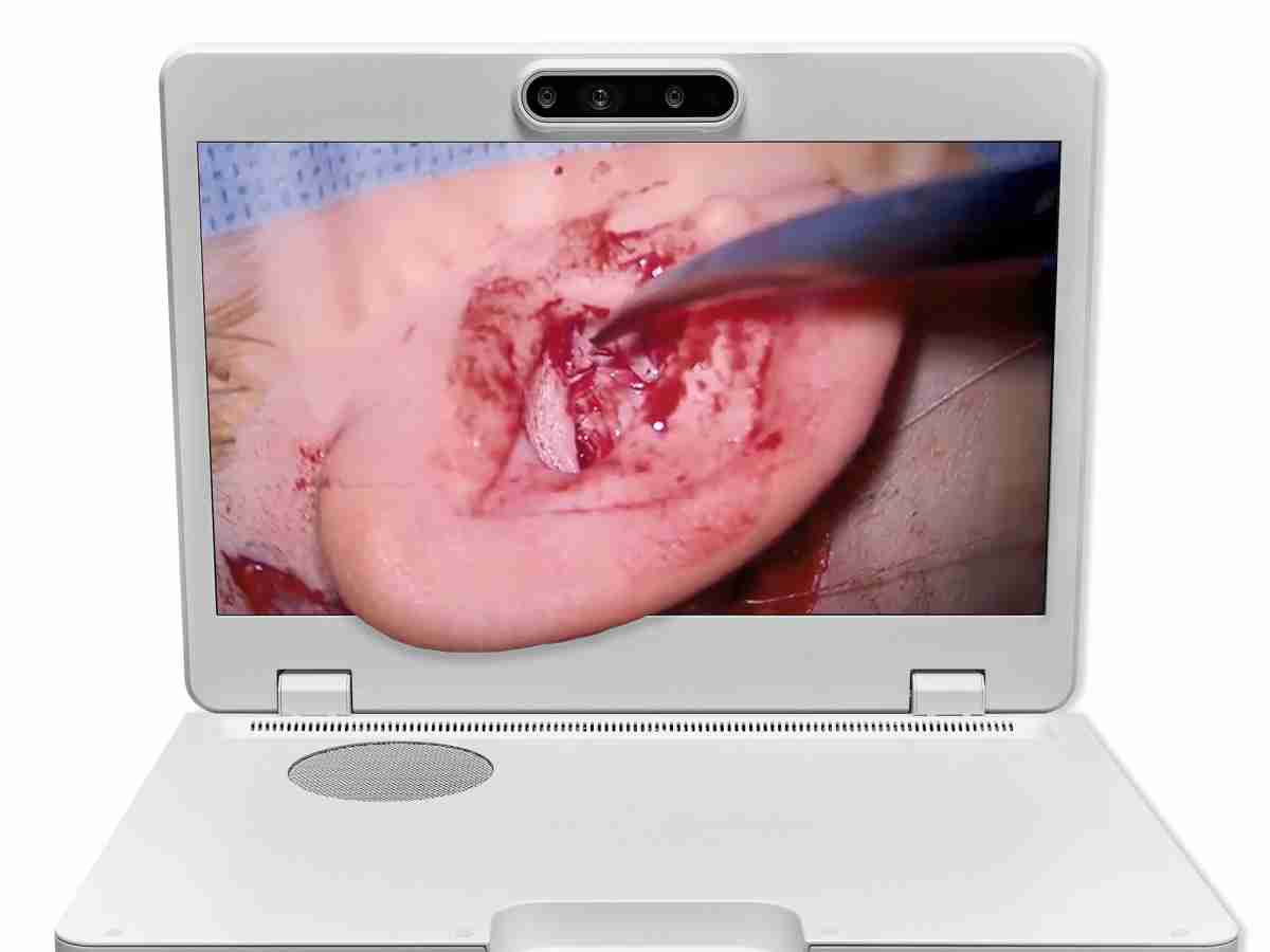 达擎之＂Heads-up 3D显微手术显示系统＂，，，整合4K裸眼3D显示及眼球追踪系统，，，，具备快速追踪人眼移动位置功能，，减轻医师长时间维持固定姿势的负担，，，，让医师能有更宽广清晰的3D立体视野及更舒适的姿势来执行手术。。。。